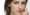 vitamin-deficiency-white-patches-on-face