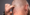how-do-i-know-if-i-have-scalp-psoriasis
