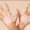 can-vitiligo-cause-other-problems