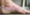 what-is-the-best-treatment-for-psoriasis-on-the-feet