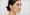 vitamin-deficiency-and-skin-pigmentation