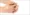 which-treatment-is-best-for-psoriasis-in-india