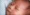 newborn-white-spots-on-face