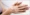 white-blotches-on-hands