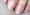 white-patch-on-fingernail