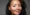 who-is-the-most-famous-person-to-have-vitiligo