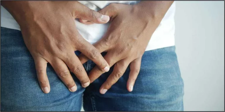 white-patches-in-groin-area-male