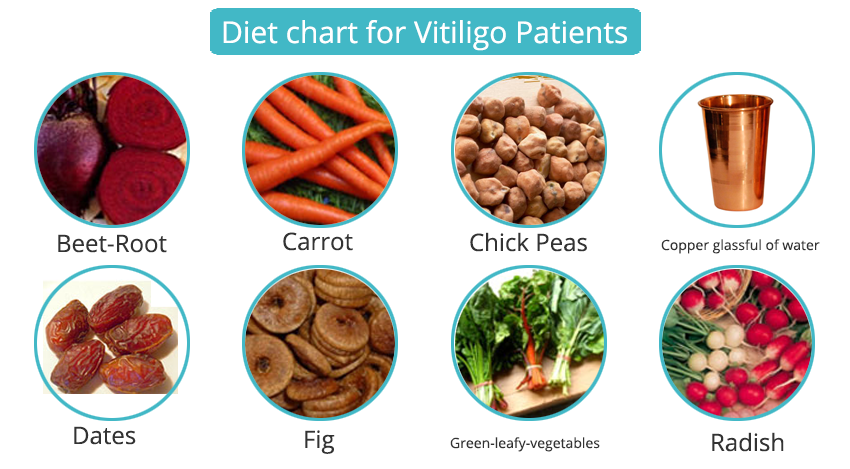Vitiligo Diet Chart In Hindi